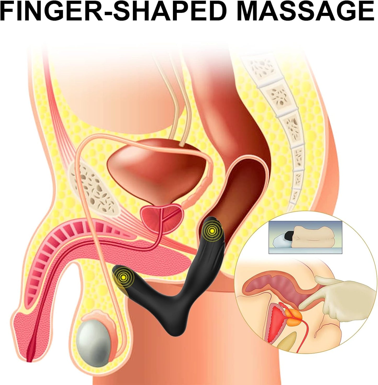 NovaReach Vibrating Remote Control Prostate Massager - SinfulX